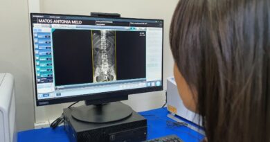 Foto: Divulgação/SES-AM